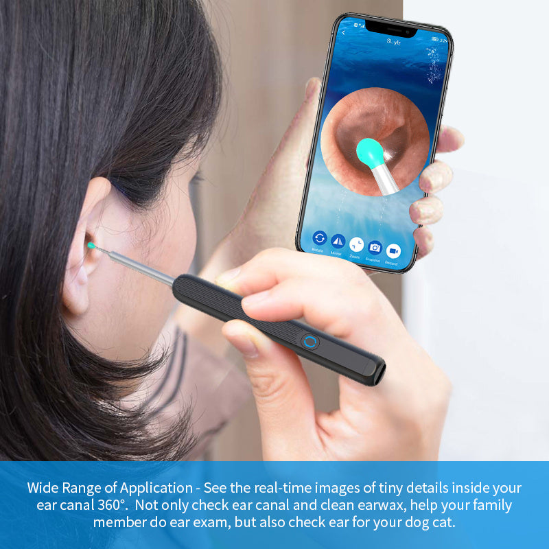 Ear Cleaner Otoscope With Camera - HexiumTech