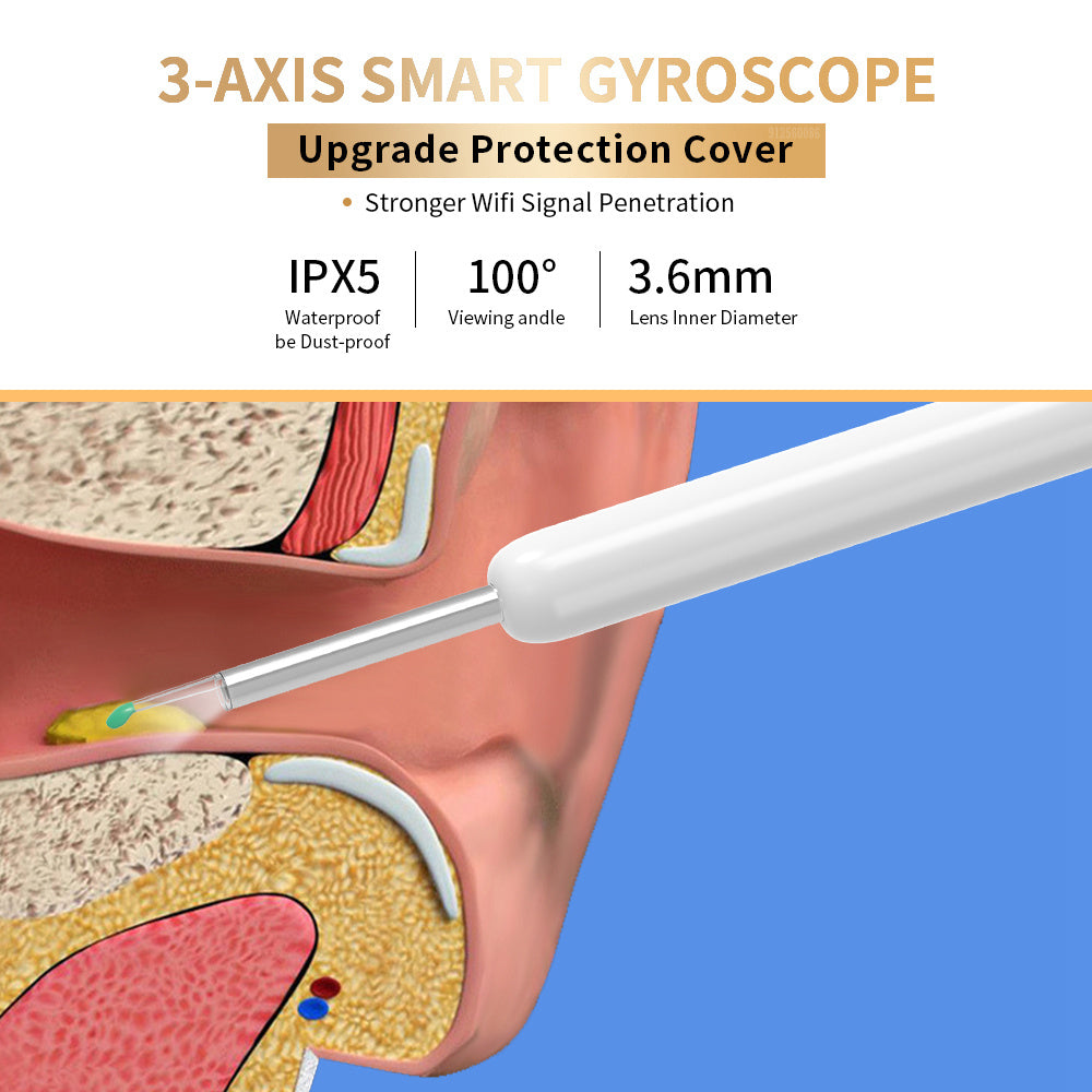 Ear Cleaner Otoscope With Camera - HexiumTech