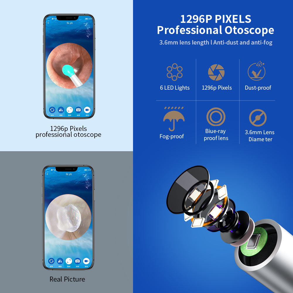Ear Cleaner Otoscope With Camera - HexiumTech